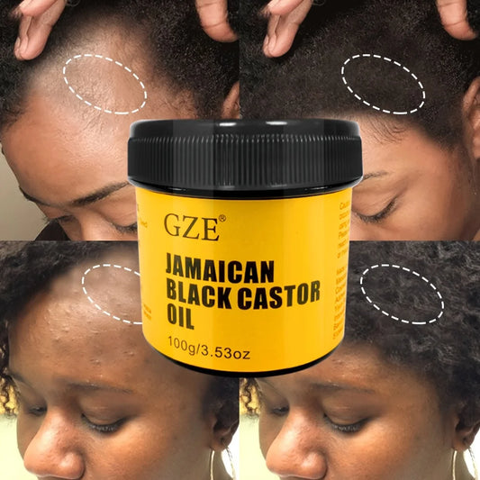 The Black Castor Oil