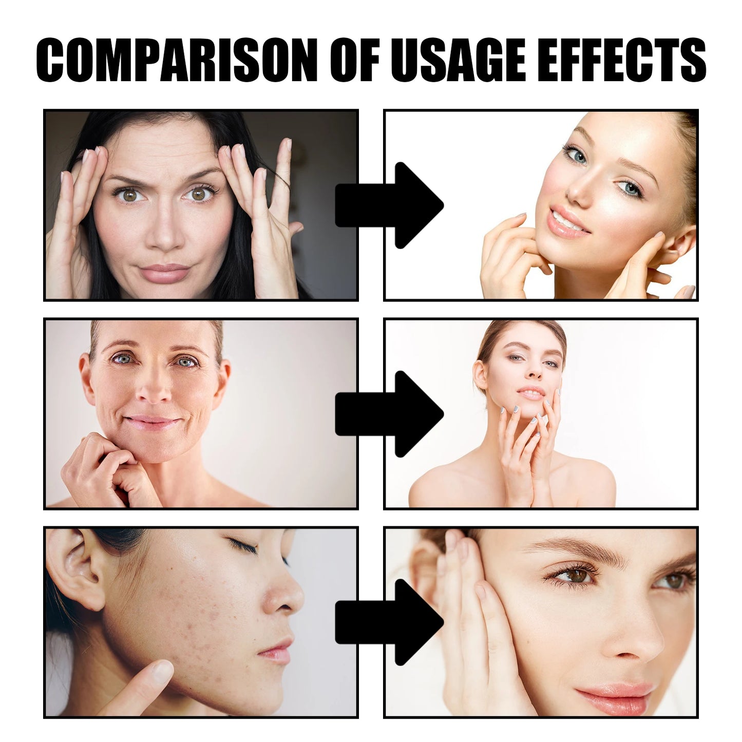 EELHOE Dragon Blood Serum Firm Skin Tightening Moisturizing Facial Rejuvenation Deep Hydration Face Care Anti-Wrinkle Serum 30ml